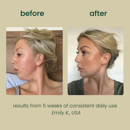 PureRise Lymphatic Drainage Drops