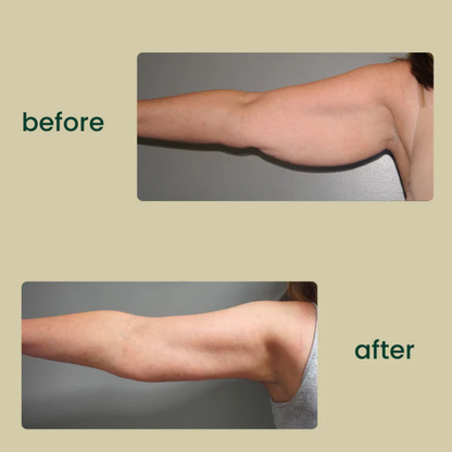 PureRise Lymphatic Drainage Drops